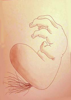 heartburn